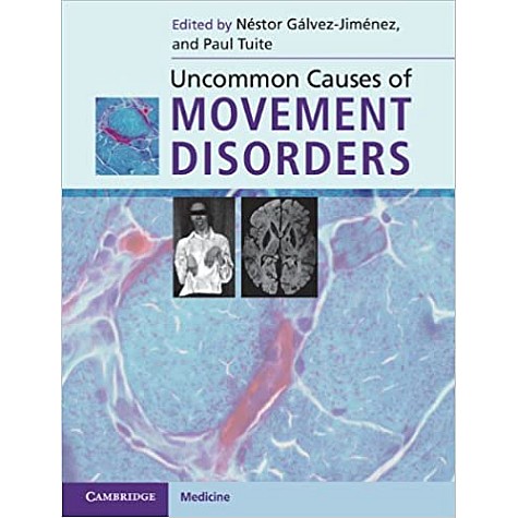 Uncommon Causes of Movement Disorders-TUITE-Camridge University Press-9780521111546 Uncommon Causes of Movement Disorders-TUITE-Camridge University Press-9780521111546