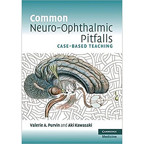COMMON NEURO-OPHTHALMIC PITFALLS-PURVIN-Cambridge University Press-9780521144575