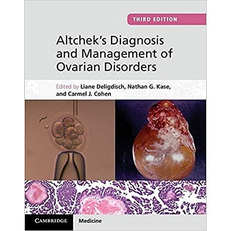 Altcheks Diagnosis and Management of Ovarian Disorders-Deligdisch-Cambridge University Press-'9781107012813 Altcheks Diagnosis and Management of Ovarian Disorders-Deligdisch-Cambridge University Press-'9781107012813