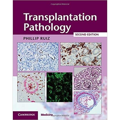 Transplantation Pathology Hardback with Online Resource 2ed-Phillip Ruiz-Cambridge University Press-9781107443280 Transplantation Pathology Hardback with Online Resource 2ed-Phillip Ruiz-Cambridge University Press-9781107443280