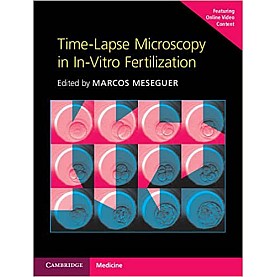 Time-Lapse Microscopy in In-Vitro Fertilization Hardback with Online Resource-Marcos Meseguer-Cambridge University Press-9781107593268