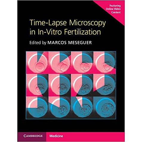 Time-Lapse Microscopy in In-Vitro Fertilization Hardback with Online Resource-Marcos Meseguer-Cambridge University Press-9781107593268 Time-Lapse Microscopy in In-Vitro Fertilization Hardback with Online Resource-Marcos Meseguer-Cambridge University Press-9781107593268