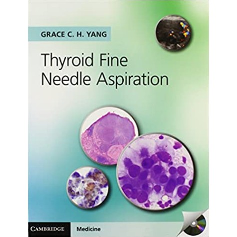 Thyroid Fine Needle Aspiration-YANG-Cambridge University Press-9781107618138 Thyroid Fine Needle Aspiration-YANG-Cambridge University Press-9781107618138