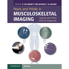 Pearls and Pitfalls in Musculoskeletal Imaging,Bennett,Cambridge University Press,9780521196321,