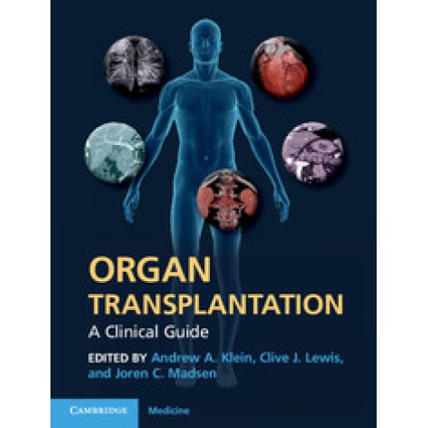 Organ Transplantation,Klein,Cambridge University Press,9780521197533,