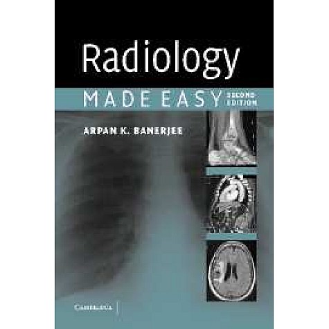 RADIOLOGY MADE EASY 2/ED,BANERJEE,CAMBRIDGE UNIVERSITY PRESS,9780521676359,