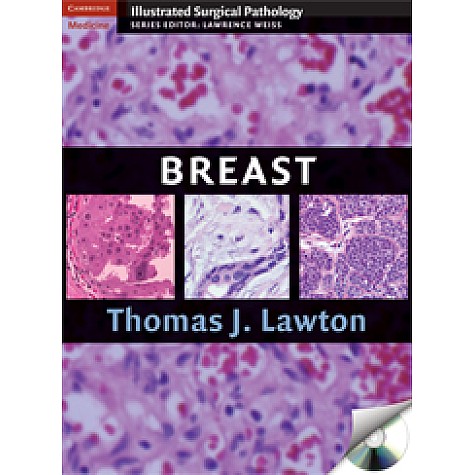 BREAST,Lawton,Cambridge University Press,9780521881593, BREAST,Lawton,Cambridge University Press,9780521881593,