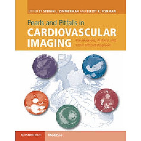 Pearls and Pitfalls in Cardiovascular Imaging,Stefan L. Zimmerman,Cambridge University Press,9781107023727, Pearls and Pitfalls in Cardiovascular Imaging,Stefan L. Zimmerman,Cambridge University Press,9781107023727,