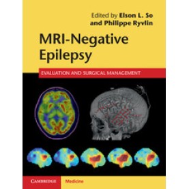 MRI-Negative Epilepsy,Elson L. So,Cambridge University Press,9781107034235,