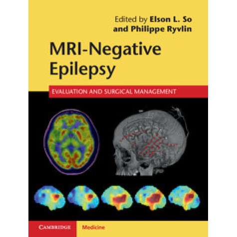 MRI-Negative Epilepsy,Elson L. So,Cambridge University Press,9781107034235, MRI-Negative Epilepsy,Elson L. So,Cambridge University Press,9781107034235,