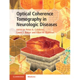 Optical Coherence Tomography in Neurologic Diseases,Peter A. Calabresi,Cambridge University Press,9781107041301, Optical Coherence Tomography in Neurologic Diseases,Peter A. Calabresi,Cambridge University Press,9781107041301,