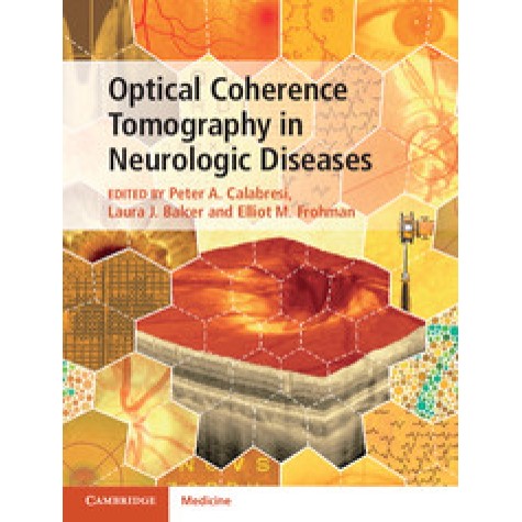 Optical Coherence Tomography in Neurologic Diseases,Peter A. Calabresi,Cambridge University Press,9781107041301, Optical Coherence Tomography in Neurologic Diseases,Peter A. Calabresi,Cambridge University Press,9781107041301,