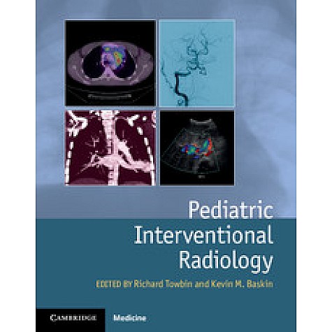Pediatric Interventional Radiology,Towbin,Cambridge University Press,9781107042629,