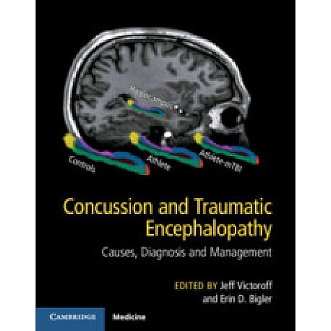Concussion and Traumatic Encephalopathy,Jeff Victoroff,Cambridge University Press,9781107073951, Concussion and Traumatic Encephalopathy,Jeff Victoroff,Cambridge University Press,9781107073951,