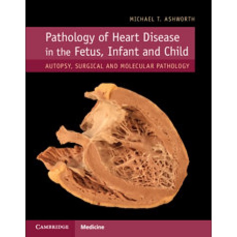 Pathology of Heart Disease in the Fetus, Infant and Child,Michael T. Ashworth,Cambridge University Press,9781107116283, Pathology of Heart Disease in the Fetus, Infant and Child,Michael T. Ashworth,Cambridge University Press,9781107116283,