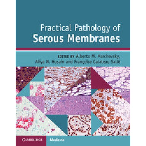 Practical Pathology of Serous Membranes,Alberto M. Marchevsky,Cambridge University Press,9781107119642, Practical Pathology of Serous Membranes,Alberto M. Marchevsky,Cambridge University Press,9781107119642,