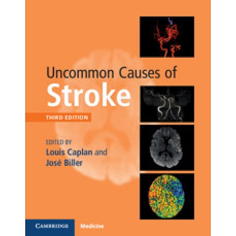 Uncommon Causes of Stroke, 3rd edition (South Asia edition)-Louis Caplan , José Biller-Cambridge University Press-9781108498432