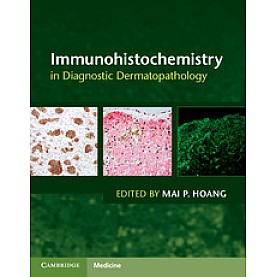 Immunohistochemistry in Diagnostic Dermatopathology,HOANG,Cambridge University Press,9781107150164, Immunohistochemistry in Diagnostic Dermatopathology,HOANG,Cambridge University Press,9781107150164,