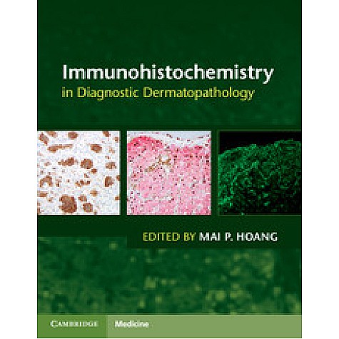 Immunohistochemistry in Diagnostic Dermatopathology,HOANG,Cambridge University Press,9781107150164,