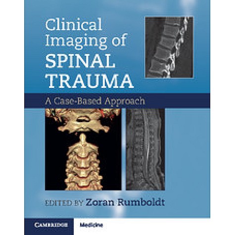 Clinical Imaging of Spinal Trauma,Edited by Zoran Rumboldt , Alessandro Cianfoni , Abhay Varma,Cambridge University Press,9781107427471,