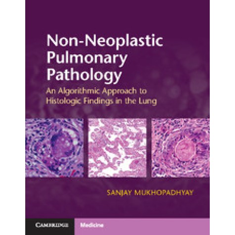 Non-Neoplastic Pulmonary Pathology with Online Resource,Sanjay Mukhopadhyay,Cambridge University Press,9781107443501,
