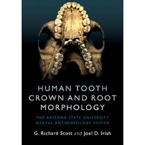 Human Tooth Crown and Root Morphology,G. Richard Scott,Cambridge University Press,9781107480735, Human Tooth Crown and Root Morphology,G. Richard Scott,Cambridge University Press,9781107480735,