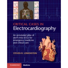 Critical Cases in Electrocardiography,R. Lowenstein,Cambridge University Press,9781107535916, Critical Cases in Electrocardiography,R. Lowenstein,Cambridge University Press,9781107535916,