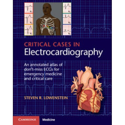 Critical Cases in Electrocardiography,R. Lowenstein,Cambridge University Press,9781107535916, Critical Cases in Electrocardiography,R. Lowenstein,Cambridge University Press,9781107535916,