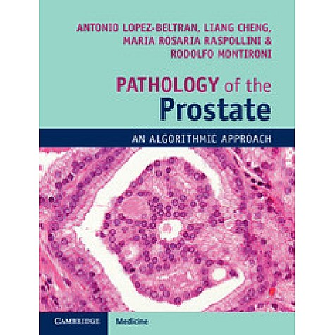 Pathology of the Prostate,Antonio Lopez-Beltran , Liang Cheng , Rodolfo Montironi , Maria Rosaria Raspollini,Cambridge University Press,9781108185653,