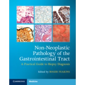 Non-Neoplastic Pathology of the Gastrointestinal Tract with Online Resource,Edited by Roger Feakins,Cambridge University Press,9781108766548,