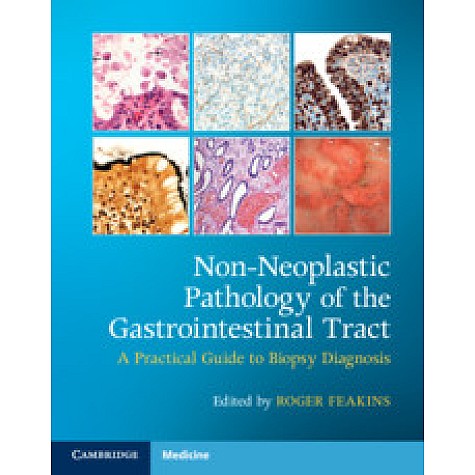 Non-Neoplastic Pathology of the Gastrointestinal Tract with Online Resource,Edited by Roger Feakins,Cambridge University Press,9781108766548,