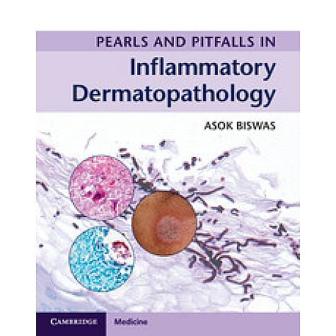Pearls and Pitfalls in Inflammatory Dermatopathology,BISWAS,Cambridge University Press,9781316605998,