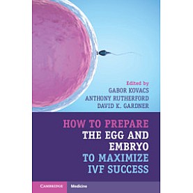 How to Prepare the Egg and Embryo to Maximize IVF Success,KOVACS,Cambridge University Press,9781316621776,