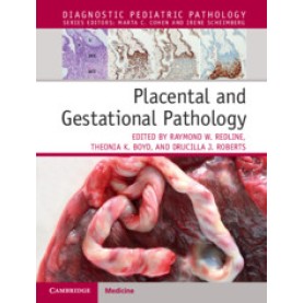 Placental Pathology,Raymond Redline,Cambridge University Press,9781316632536,