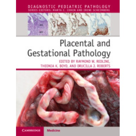 Placental Pathology,Raymond Redline,Cambridge University Press,9781316632536, Placental Pathology,Raymond Redline,Cambridge University Press,9781316632536,