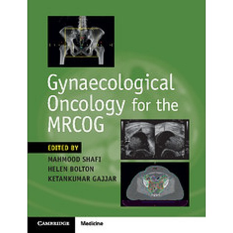 Gynaecological Oncology for the MRCOG,Mahmood Shafi,Cambridge University Press,9781316638712,