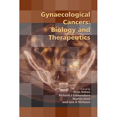 Gynaecological Cancers,KEHOE,Cambridge University Press,9781906985448,