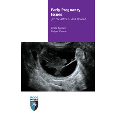 Early Pregnancy Issues for the MRCOG and Beyond,Kumar,Cambridge University Press,9781906985455, Early Pregnancy Issues for the MRCOG and Beyond,Kumar,Cambridge University Press,9781906985455,