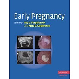 Early Pregnancy,Farquharson,Cambridge University Press,9780521517089, Early Pregnancy,Farquharson,Cambridge University Press,9780521517089,