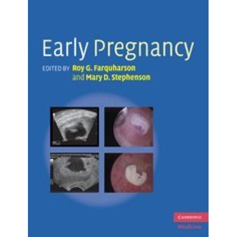 Early Pregnancy,Farquharson,Cambridge University Press,9780521517089, Early Pregnancy,Farquharson,Cambridge University Press,9780521517089,