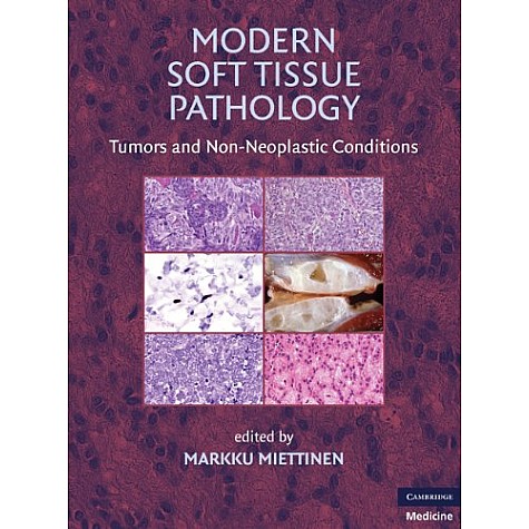 Modern Soft Tissue Pathology,Miettinen,Cambridge University Press,9780521874090,