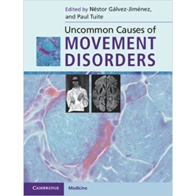 Uncommon Causes of Movement Disorders-TUITE-Camridge University Press-9780521111546