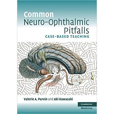 COMMON NEURO-OPHTHALMIC PITFALLS-PURVIN-Cambridge University Press-9780521144575