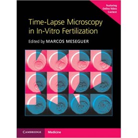 Time-Lapse Microscopy in In-Vitro Fertilization Hardback with Online Resource-Marcos Meseguer-Cambridge University Press-9781107593268