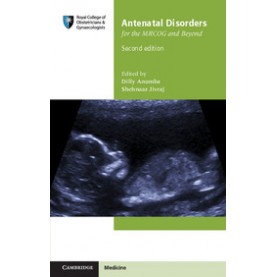 Antenatal Disorders for the MRCOG and Beyond-Dilly Anumba, University of Sheffield Jivraj, University of Sheffield-CAMBRIDGE UNIVERSITY PRESS- 9781107684928