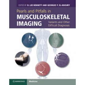 Pearls and Pitfalls in Musculoskeletal Imaging,Bennett,Cambridge University Press,9780521196321,