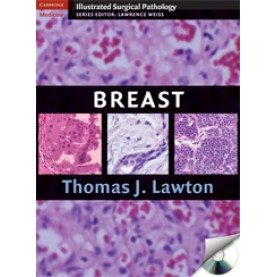 BREAST,Lawton,Cambridge University Press,9780521881593,