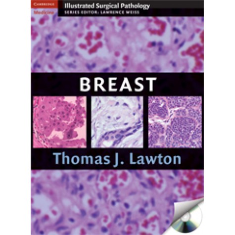 BREAST,Lawton,Cambridge University Press,9780521881593,