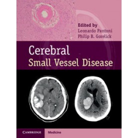 Cerebral Small Vessel Disease,Leonardo Pantoni,Cambridge University Press,9781107031661,
