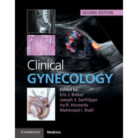 Clinical Gynecology 2nd ed,Eric J. Bieber,Cambridge University Press,9781107040397,